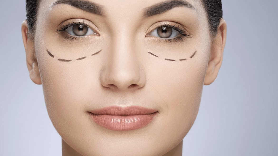 Blefaroplastia o Cirugía de Párpados en Cuenca Pablo Salamea Blefaroplastia o Cirugía de Párpados en Cuenca Pablo Salamea