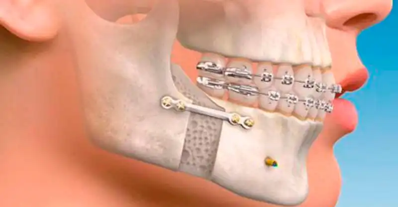 Cirugia-maxilofacial-dr-pablo-salamea-molina-en-cuenca