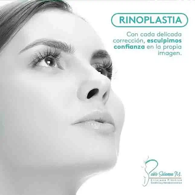 Rinoplastia en Cuenca
Recuperación