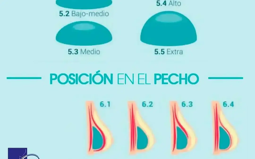Aumento de Senos – Encuentra el Volumen y Forma Perfecta para Ti