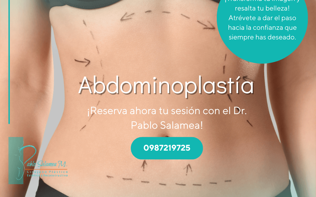 Abdominoplastia en Cuenca