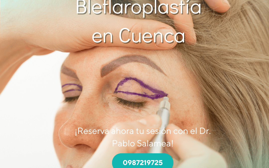 Blefaroplastía en Cuenca: Rejuvenece Tu Mirada