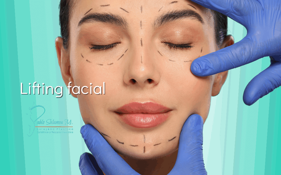 Lifting Facial en Cuenca: Rejuvenece Tu Rostro