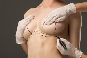 Cropped View Of Plastic Surgeon In Latex Gloves Ma 2026 01 06 00 40 11 Utc