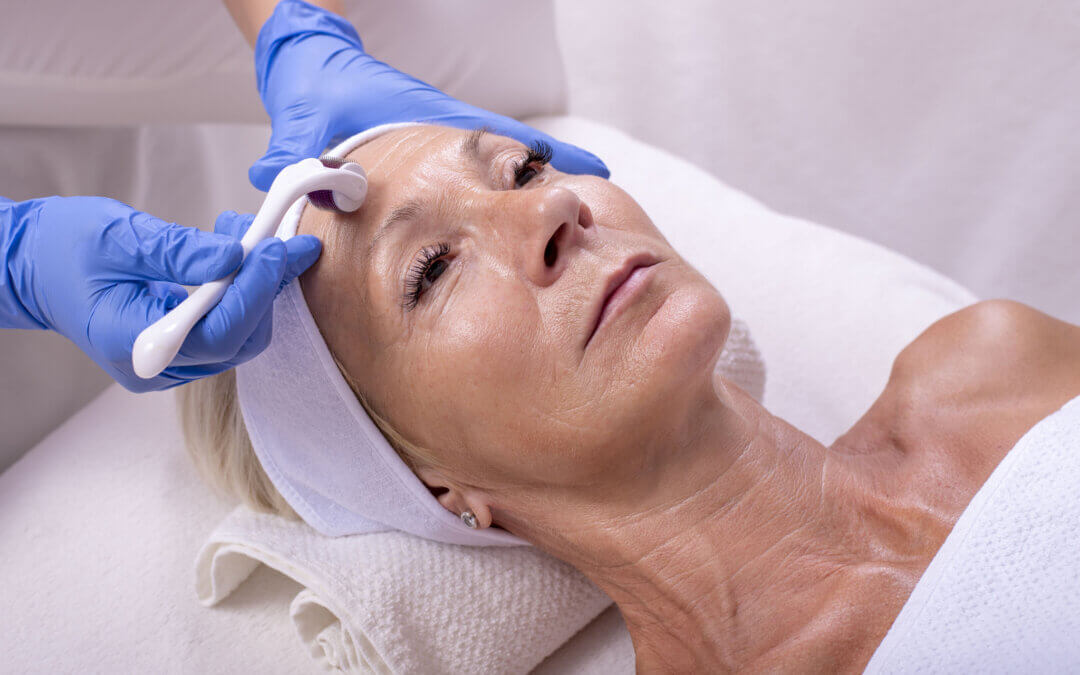 Lifting Facial en Cuenca: El Arte de Restaurar