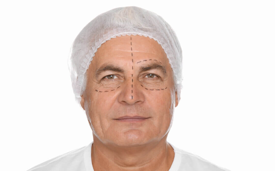 Blefaroplastia en Cuenca | Dr. Pablo Salamea