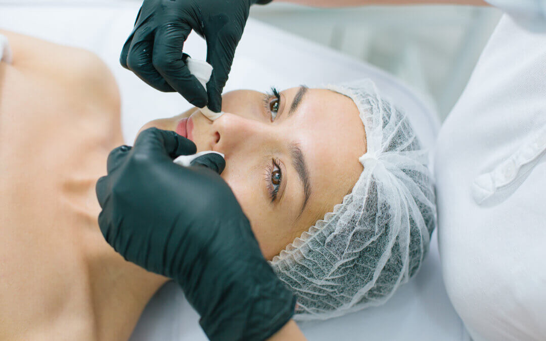 Rinoplastia en Ecuador: armonía facial y salud con expertos